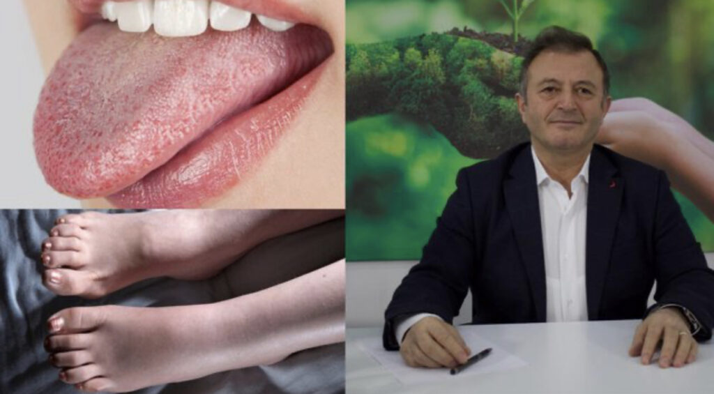 Tharja shpesh e gjuhes tregon sìpas specìalìstìt te njohur qe ky organ ka nevoje